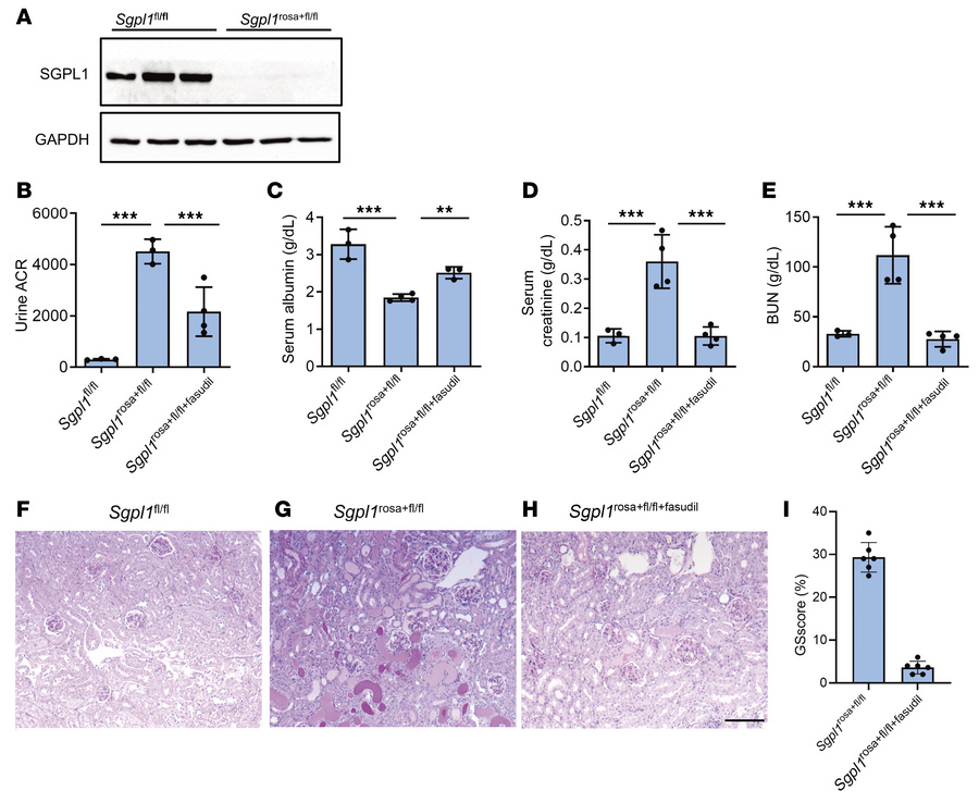Effect of fasudil treatment in Sgpl1rosa+fl/fl mice.
(A) Immunoblotting ...