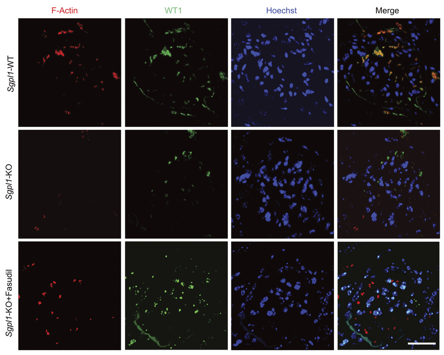 F-Actin and WT1 staining of kidneys of WT, Sgpl1-KO, and Sgpl1-KO mice t...