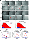 Cytoskeletal dynamics and lipid metabolism in SPLIS fibroblasts after So or