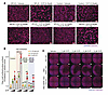 Fasudil rescues S1P induced cytoskeletal phenotypes in SPLIS fibroblasts an
