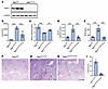 Effect of fasudil treatment in Sgpl1rosa+fl/fl mice.