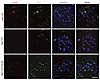 F-Actin and WT1 staining of kidneys of WT, Sgpl1-KO, and Sgpl1-KO mice trea