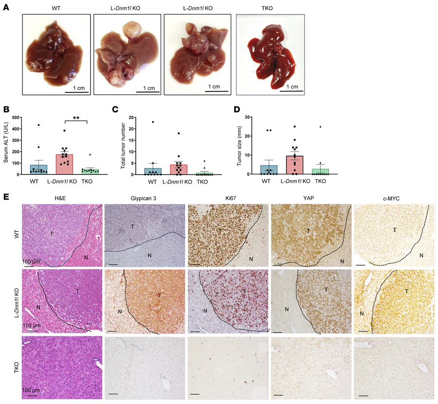 Increased oncogene-driven liver tumorigenesis in L-Dnm1l–KO but not TKO ...