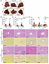 Spontaneous liver tumorigenesis and fibrosis in L-Dnm1l–KO mice were rescue