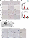 Increased DNA damage and proliferation in L-Dnm1l–KO but not TKO mice.