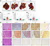Increased oncogene-driven liver tumorigenesis in L-Dnm1l–KO but not TKO mic