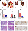 Loss of hepatic cGAS inhibits oncogene-driven liver tumor development.