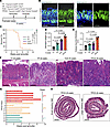 Kmt2c/d knockout cooperates with Pten loss to induce muscle-invasive gastri