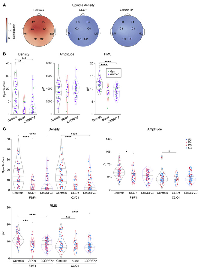 Sleep spindle alterations in presymptomatic ALS gene carriers.
(A) Topog...
