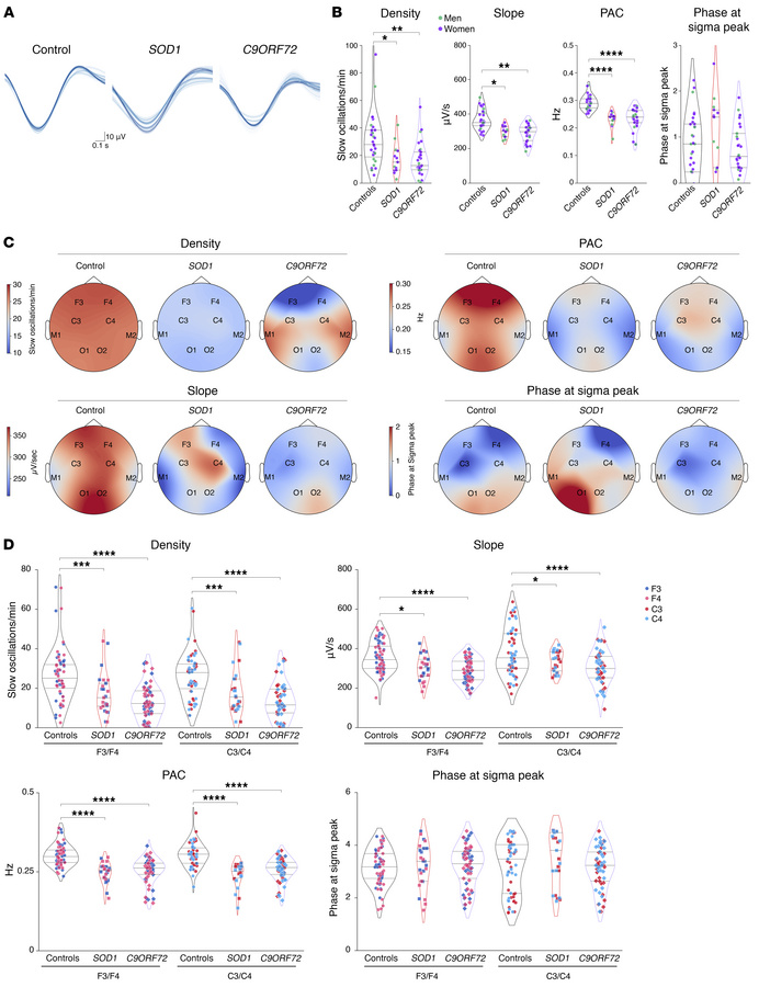 Slow oscillation alterations in presymptomatic ALS gene carriers.
(A) Re...