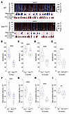 Sleep microarchitecture alterations in Sod1G86R, FusΔNLS/+, and TDP-43Q331K