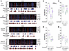 Improved sleep microarchitecture by suvorexant-treated Sod1G86R, FusΔNLS/+,