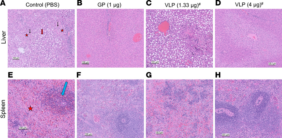 Histopathology of liver and spleen tissues from control and vaccinated g...