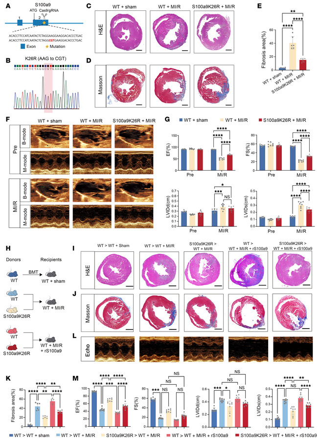 Deletion of S100a9K26-specific lactylation improves post-MI/R cardiac fu...