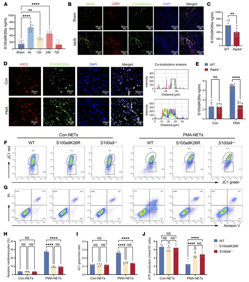 Lactylated S100a9 is released via NETs and triggers CM death by impairin...