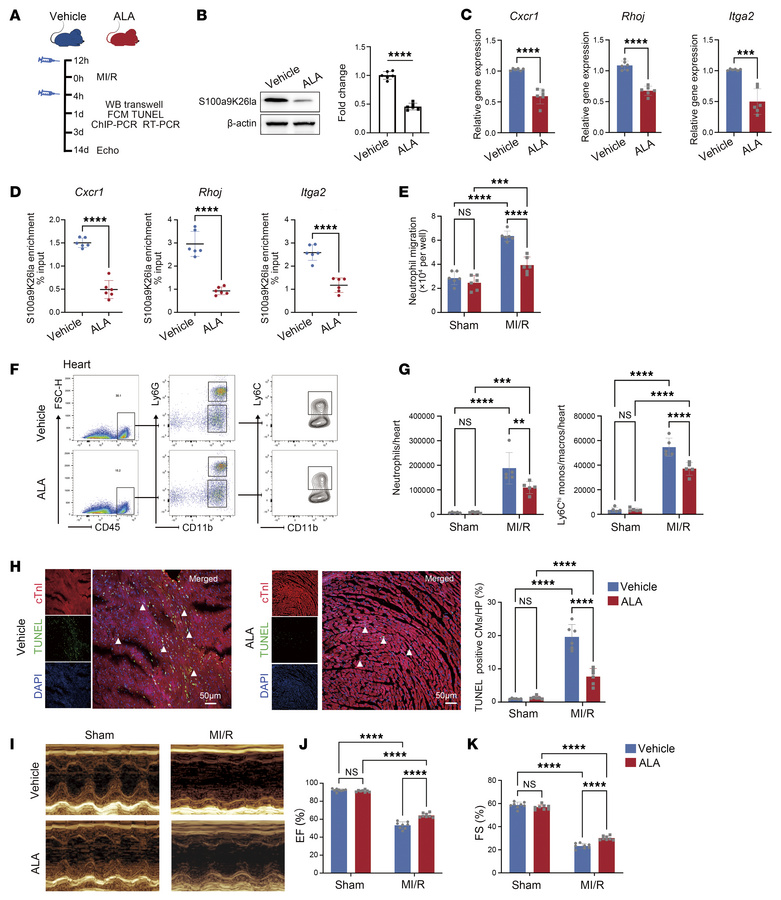 ALA inhibits S100a9 lactylation and improves MI/R
outcomes. (A) Experime...