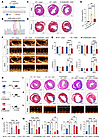 Deletion of S100a9K26-specific lactylation improves post-MI/R cardiac funct