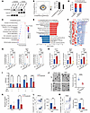 S100a9K26 lactylation boosts the transcription of neutrophil migration and