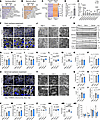 Pharmacological inhibition of CER synthesis improves mitochondrial function