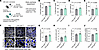 Liver-specific knockdown of CER synthesis improves cachectic phenotypes and