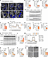 CERs directly interfere with mitochondrial function and induce cachexia-lik