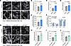 Inhibition of CER synthesis improves mitochondrial phenotypes in skeletal m