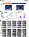 Acquired MET amplification in a LUAD BM that was responsive to capmatinib.