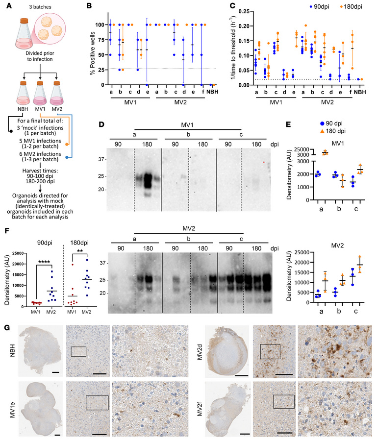 Prion infection of the cerebral organoids.
(A) Schematic showing the exp...