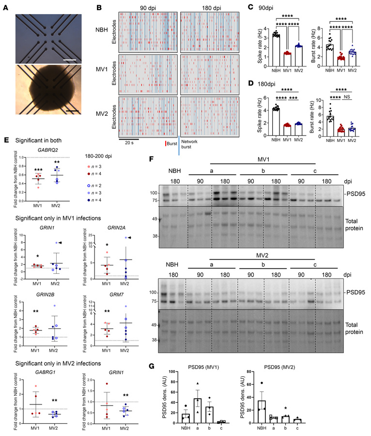 Neuronal dysfunction is a phenotype shared by MV1 and MV2 infected organ...