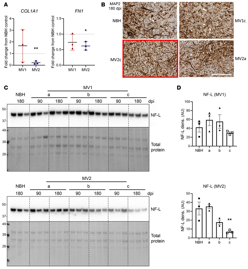 MV2-infected organoids show extracellular matrix breakdown.
(A) qRT-PCR ...