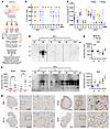 Prion infection of the cerebral organoids.