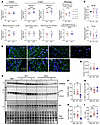 Organoids have reduced mitofusin transcripts but unaltered mitochondrial fu