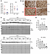 MV2-infected organoids show extracellular matrix breakdown.