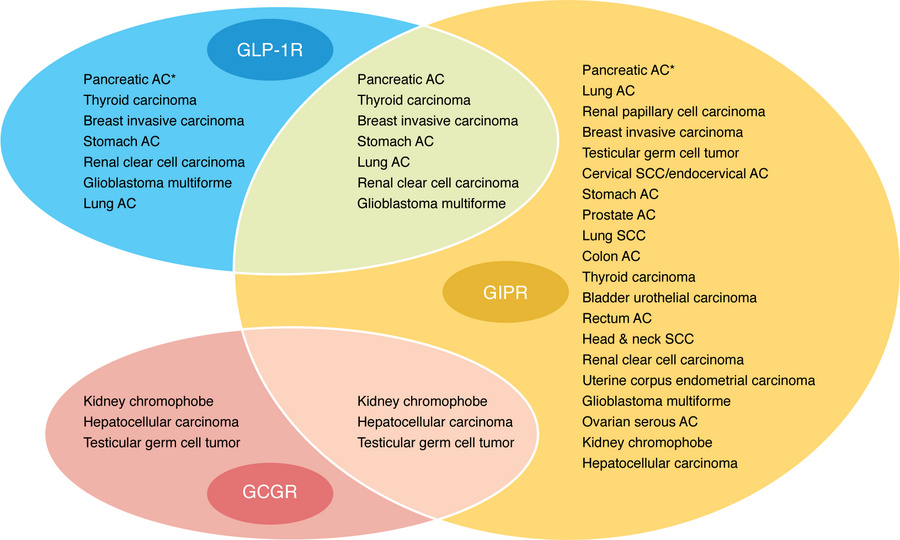 Expression of GLP-1R, GIPR, and GCGR in human tumor tissues.
Tumor tissu...
