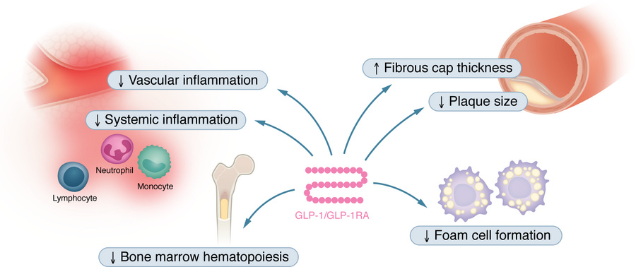 The effects of GLP-1 and GLP-1RAs on atherosclerosis.
Abundant evidence ...