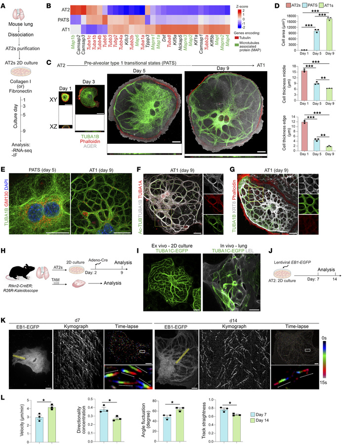 Alveolar stem cell MTs undergo dynamic changes to form thick MT bundles ...