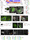 Alveolar stem cell MTs undergo dynamic changes to form thick MT bundles dur