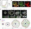 Dynamic expression and localization of TAU precede thick MT bundle formatio