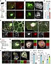 TAU regulates the formation of thick MT bundles.