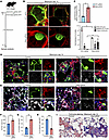 Loss of Mapt leads to abnormal cell organization and increased fibrosis in