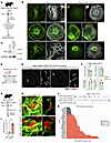 Loss of TP53 disrupts MT organization and AT1 differentiation.