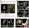 MAPT regulates human AT2 differentiation into AT1s.