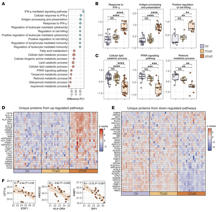 Altered biological pathways in the crypt regions of untreated CeD.
(A) T...