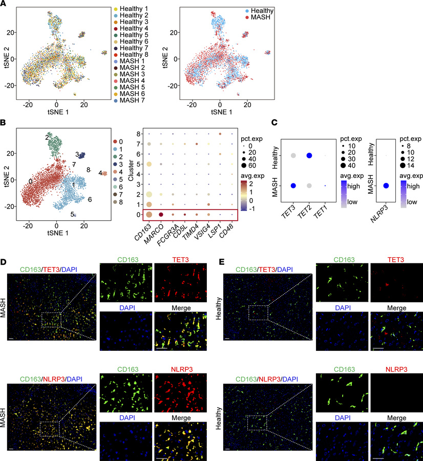 TET3- and NLRP3-overexpressing macrophages in human MASH liver.
(A) Dime...