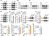 Toe-Macs induced by DME factors exhibit elevated NLRP3 activity.