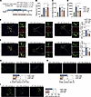Toe-Macs are mechanistically linked to diet-induced MASH.
