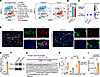 Toe-Macs present in human NSCLC epigenetically promote PD-L1 expression.