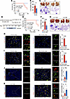 Toe-Macs contribute to an immunosuppressive TME in NSCLC.