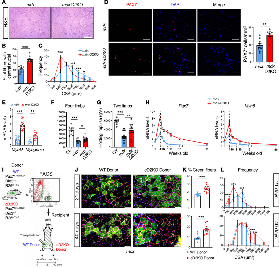 D2KO improves the phenotype of mdx mice.
(A) Representative H&amp;E of T...