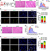Absence of D2 leads to faster proliferation of MuSCs and transiently accele